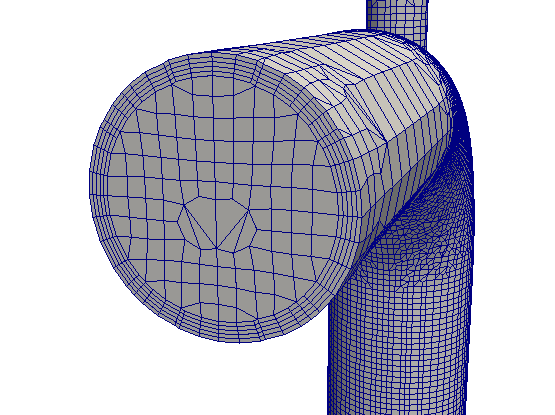 Creates 5 layers mesh on the inner wall with a thickness ratio 0.2